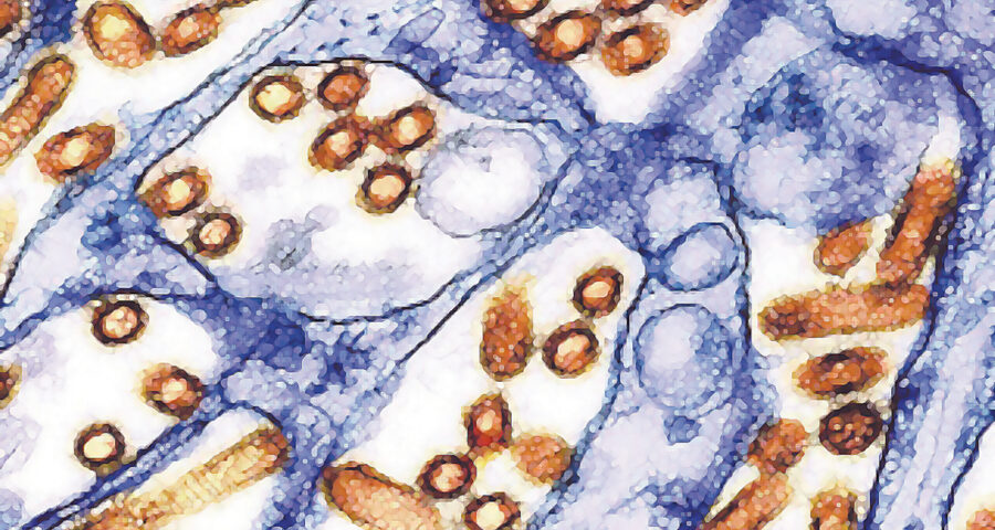 Gelb-rote Partikel des Vogelgrippe-A-Virus H5N1. Bild: CDC, NIAID